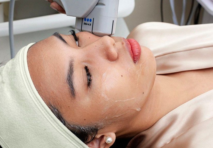 HIFU facial: What is it, how it works, effects, cost, and more