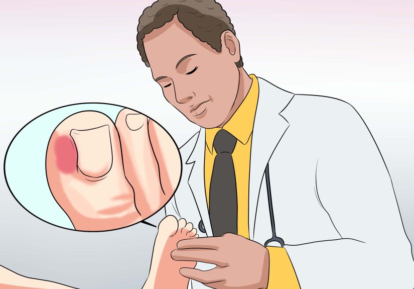 3 Ways to Cure an Infected Toe