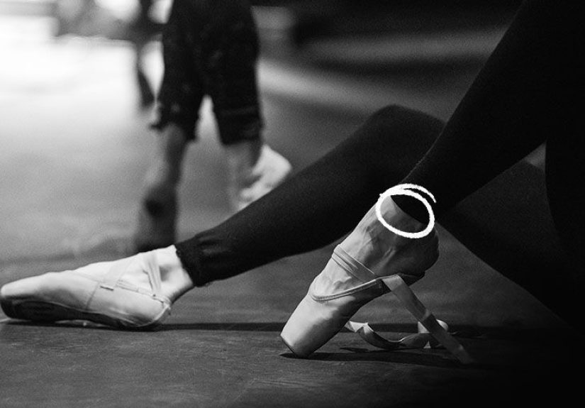 Ankle bursitis: Symptoms, causes, and treatment