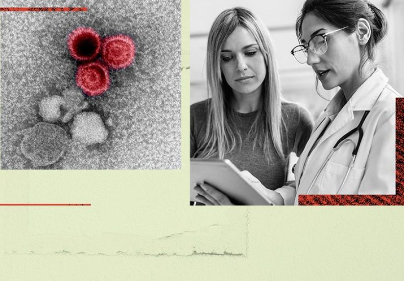 Could the Epstein-Barr virus be the culprit behind lupus?