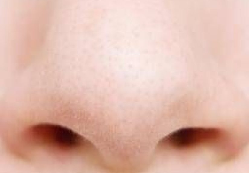 Deviated septum: Causes, symptoms, and treatment