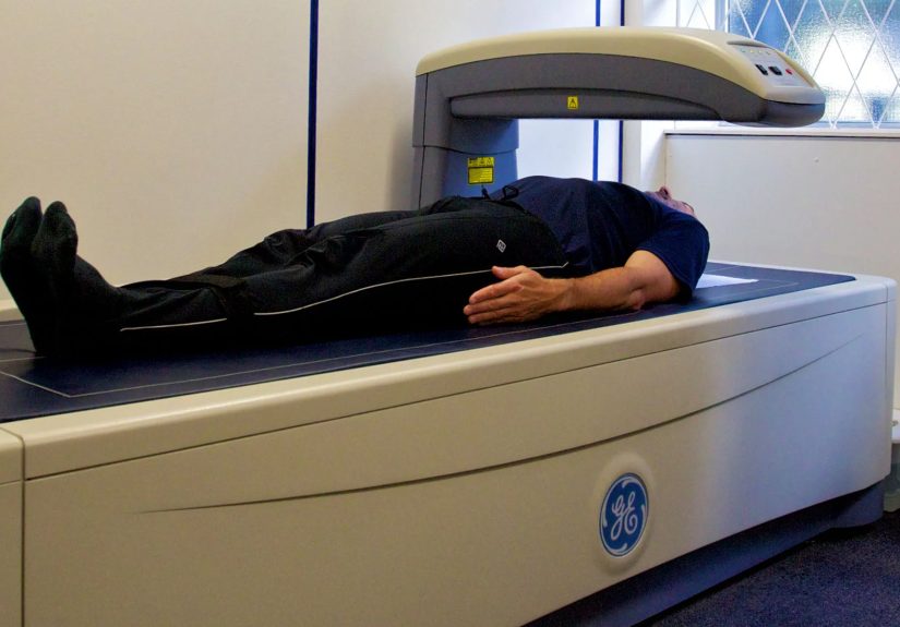 DEXA Scan (Dual X-ray Absorptiometry): A Test to Measure Bone Mineral Density