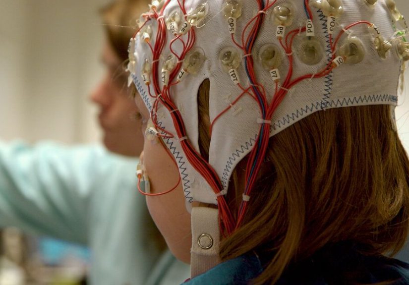 EEG (Electroencephalogram): Purpose, Procedure, and Risks