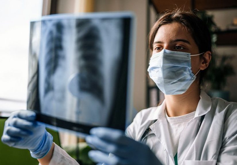 Ground glass opacity: Causes, symptoms, and treatments