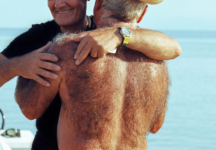 Hairy Back Causes and Treatment: Shave, Wax, or Leave?