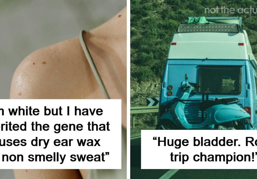 &ldquo;Haven&rsquo;t Had To Shave In 26 Years&rdquo;: 86 Lucky People Who Absolutely Won The Genetic Lottery
