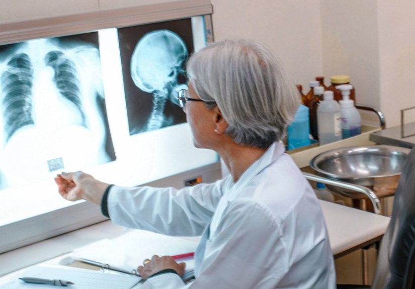 Hepatic Hydrothorax: Symptoms, Causes, Diagnosis, Treatment