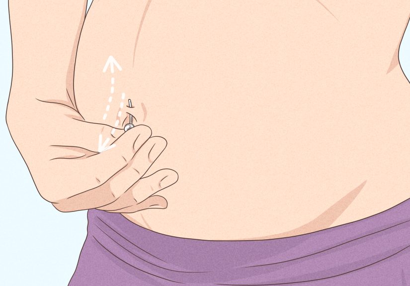 How to Manage Belly Button Rings During Pregnancy: 12 Steps
