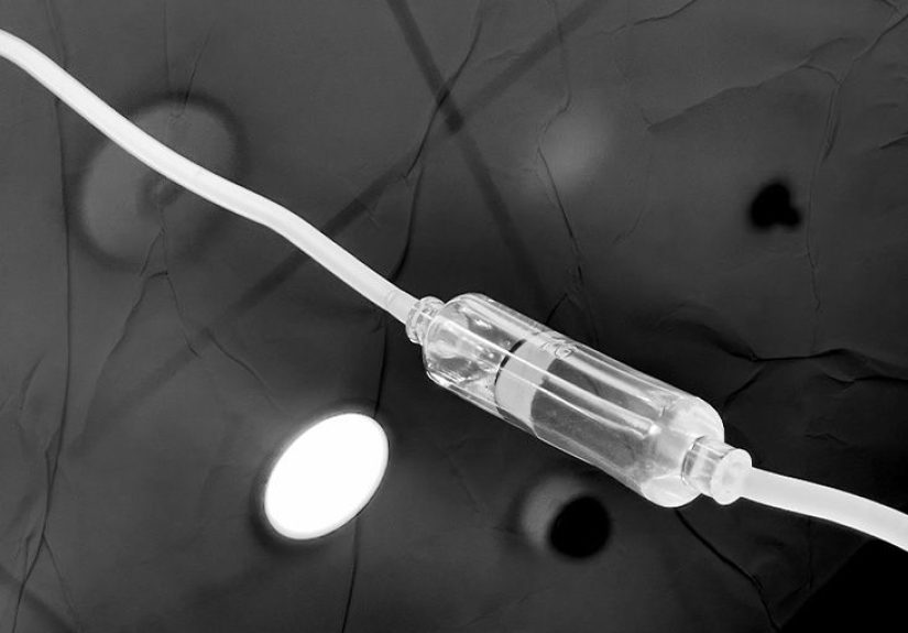 Intravesical chemotherapy: Procedure, side effects, and outlook
