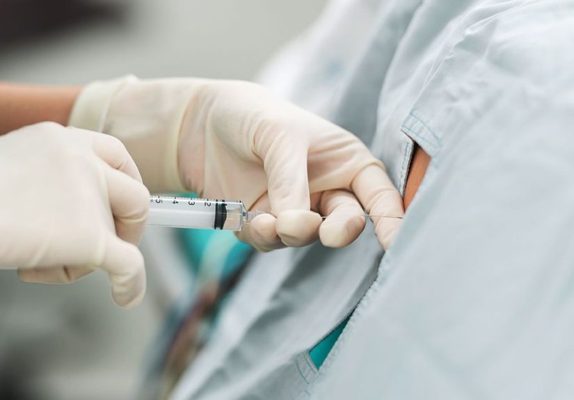 Medicare and Epidural Steroid Injections