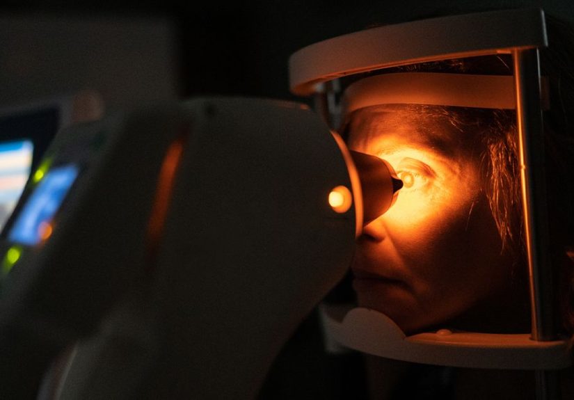 Posterior Subcapsular Cataract: Causes, Symptoms, Treatment