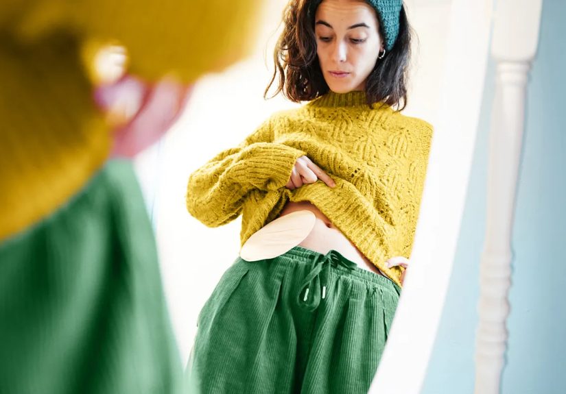 Sex With a Stoma Bag: 5 Tips for Intimacy After Ostomy