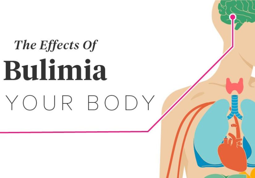 The Long-Term Effects of Bulimia on the Body