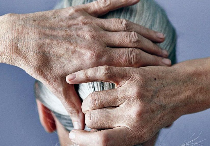 Thinning Hair: Causes, Types, Treatment, and Remedies