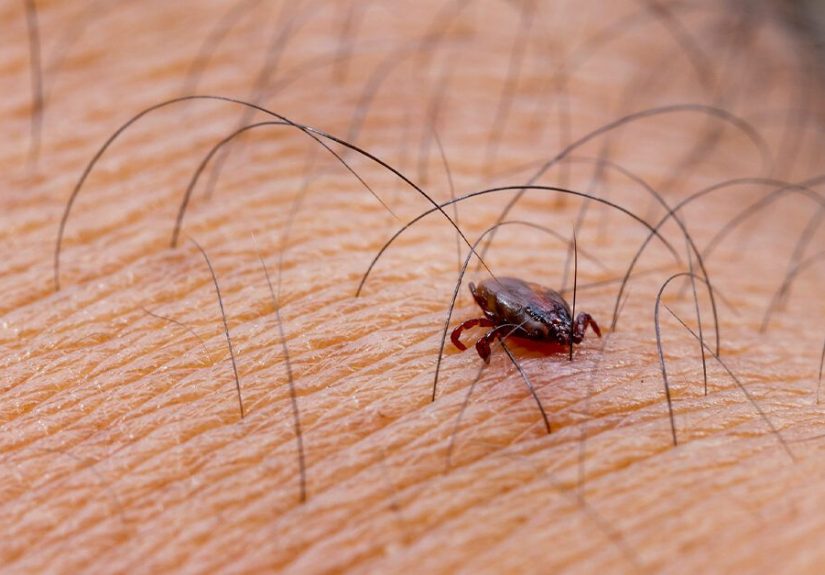 What Is Anaplasmosis? Know the Signs and How to Prevent It