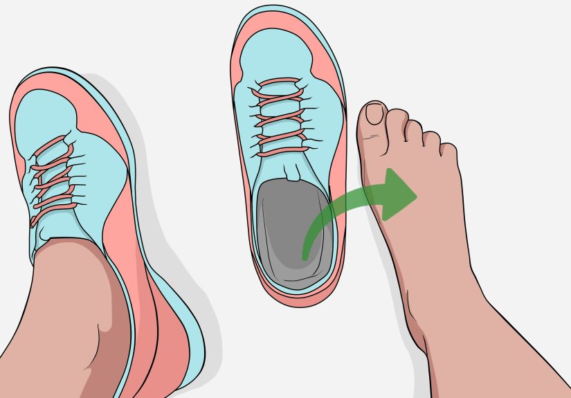 3 Ways to Tell if an Ingrown Toenail Is Infected