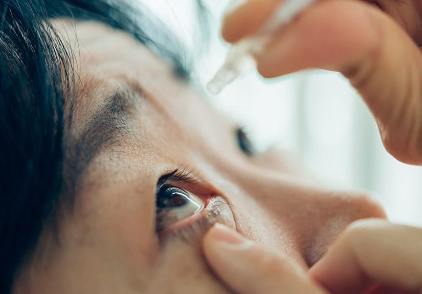 Castor Oil and Cataracts: Can It Help?