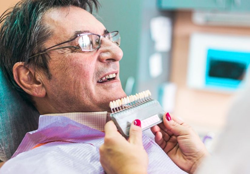 Composite Veneers Pros & Cons, Procedure, Cost, and Alternatives