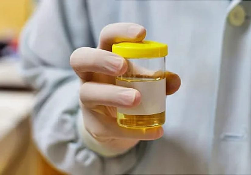 Dysuria: Causes and Treatments