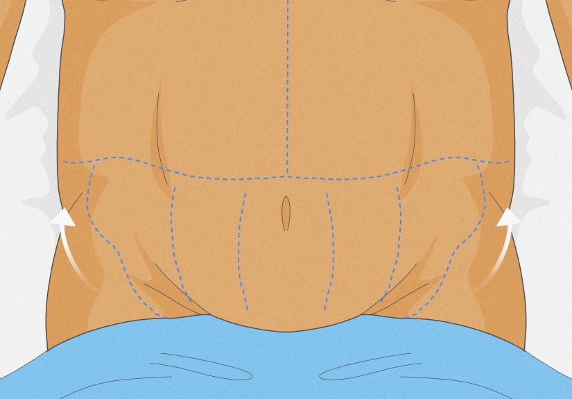How to Lose Groin Fat (for Men): Exercises & Diet Tips