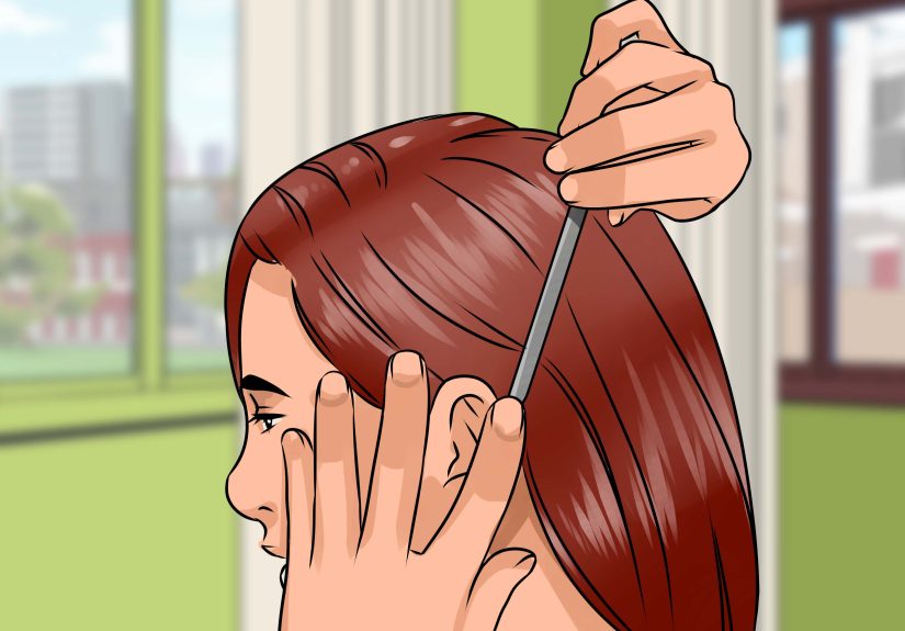How to Remove a Blackhead from Your Forehead: 12 Steps