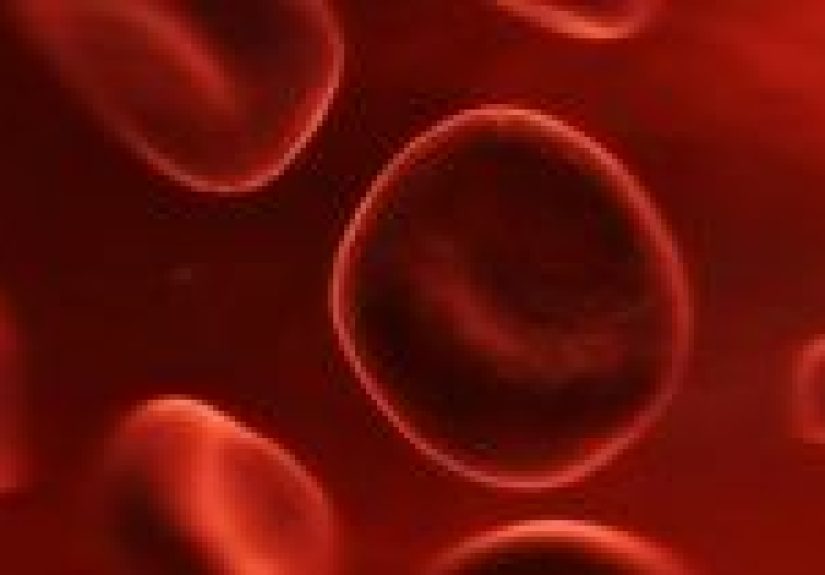 Linfoma en etapa 4: Tipos, síntomas y tratamientos