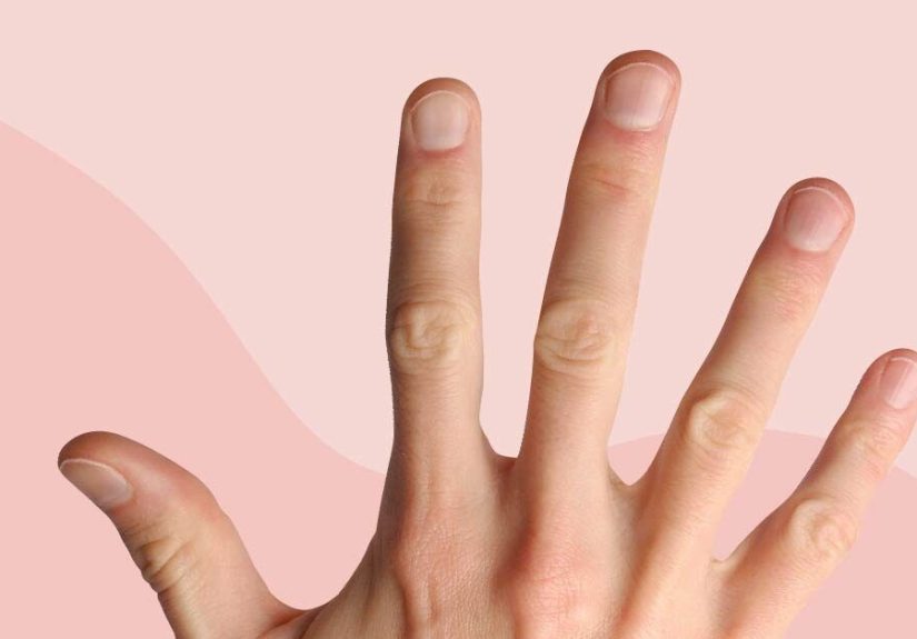 Nail Health Chart: Common Problems and Treatment