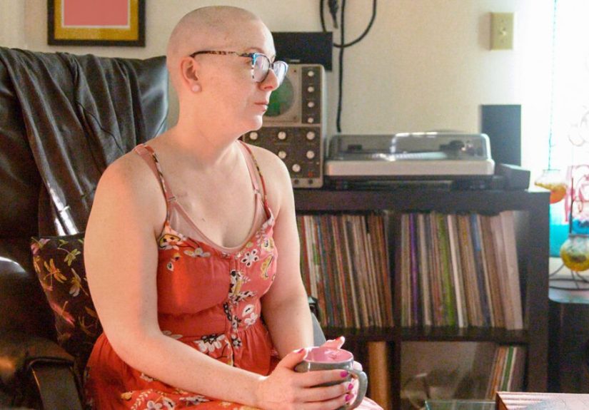 Ovarian cancer treatment: Stages 1, 2, 3, and 4