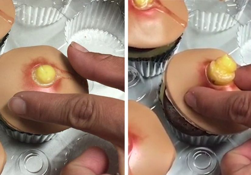 Pimple Cupcakes With Squeezable Heads Are A Thing Now (Unfortunately)