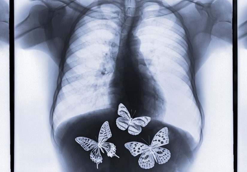 Stomach Churning: Causes, Treatment, Prevention, and FAQs