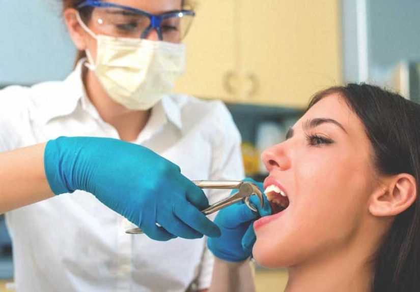 Tooth Extraction: Cost, Procedure, Risks, and Recovery