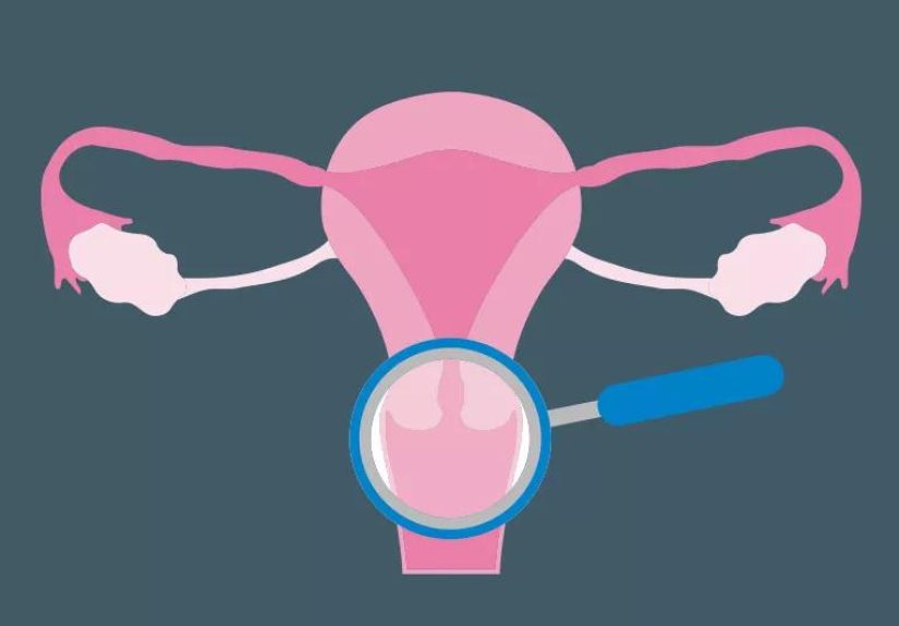 What to Expect After an Abnormal Pap Smear