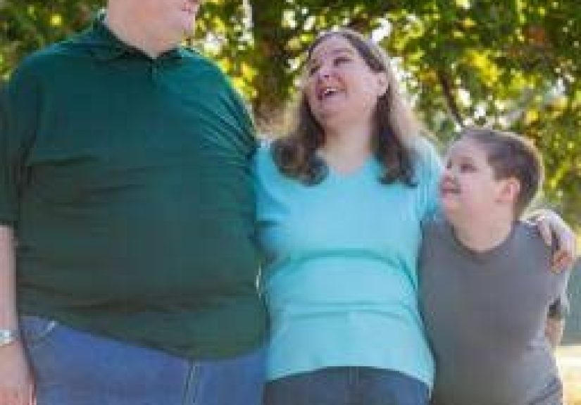 5 Surprising Facts About Obesity