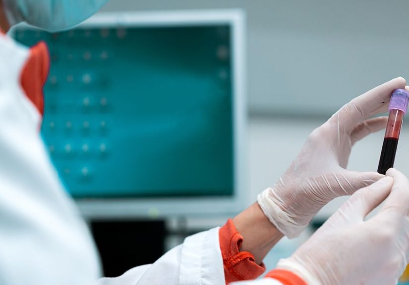 Antibodies in Hyperthyroidism: What Do They Mean?
