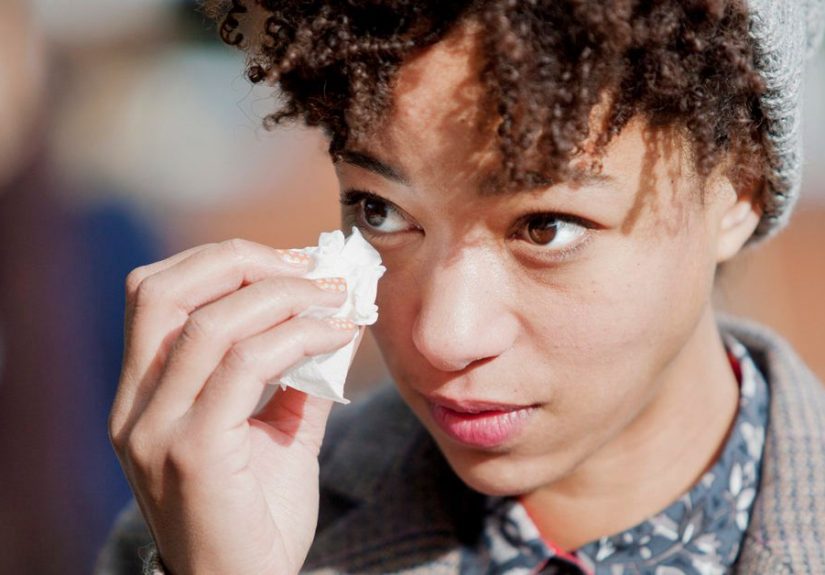 Epiphora (Watering Eyes): Causes and Treatment