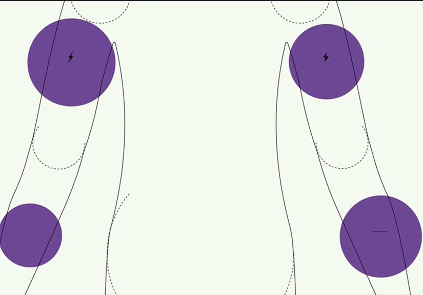 How Targeting One Gene Treats Spinal Muscular Atrophy
