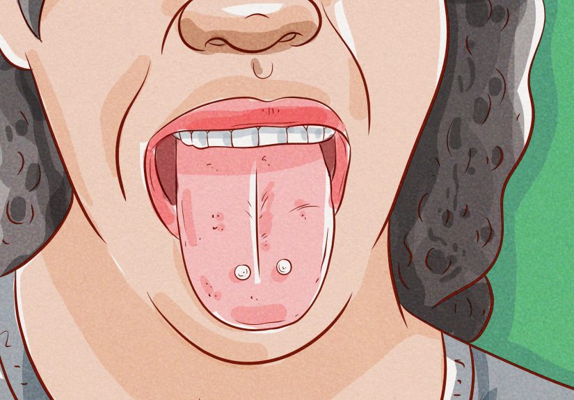 How to Brush Your Teeth with a Tongue Piercing: 14 Steps
