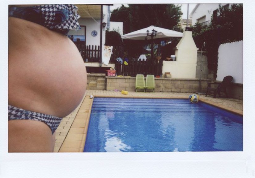Interstitial Cystitis and Pregnancy: What to Know
