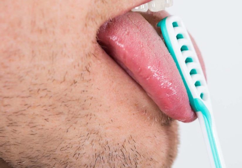 Orange Tongue: 4 Causes and Other Colors